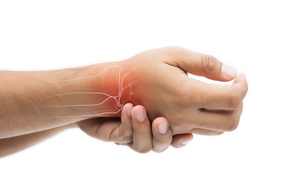 Physical Therapy For Non-Pharmaceutical Arthritis Pain Management