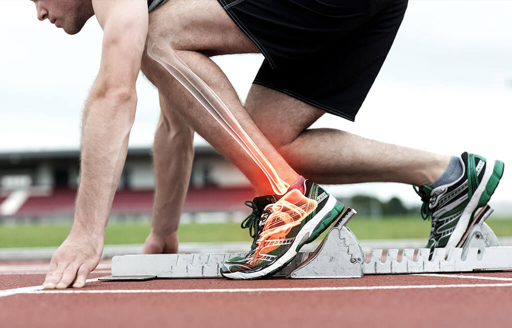 What’s overstriding, and why can this be a problem for runners?